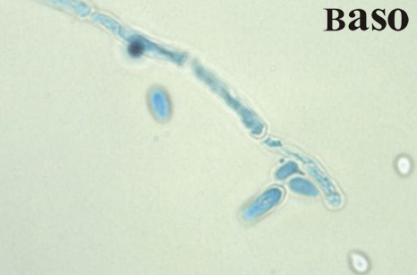 ��������{(l��n)ȾɫҺ