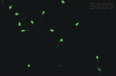 ����DNAȾɫԇ���У�߹ळȷ���