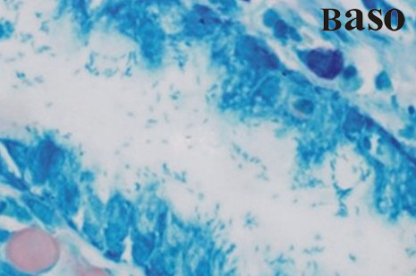 θ���T�ݗU��ȾɫҺ�����{����