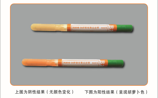 BȺ�����\(y��n)�����B(y��ng)�ܣ�GBS��