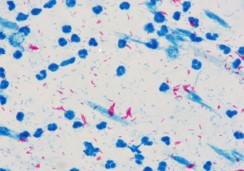 Ⱦɫ�C(j��)��̖(h��o)